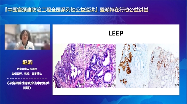 派特生物公益|中国宫颈癌防治工程·派特在行动公益讲堂隆重开幕