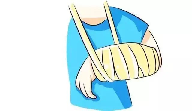 孟氏骨折+盖氏骨折：肘腕同时“告急”，平医多科联动打赢“保肢战役”