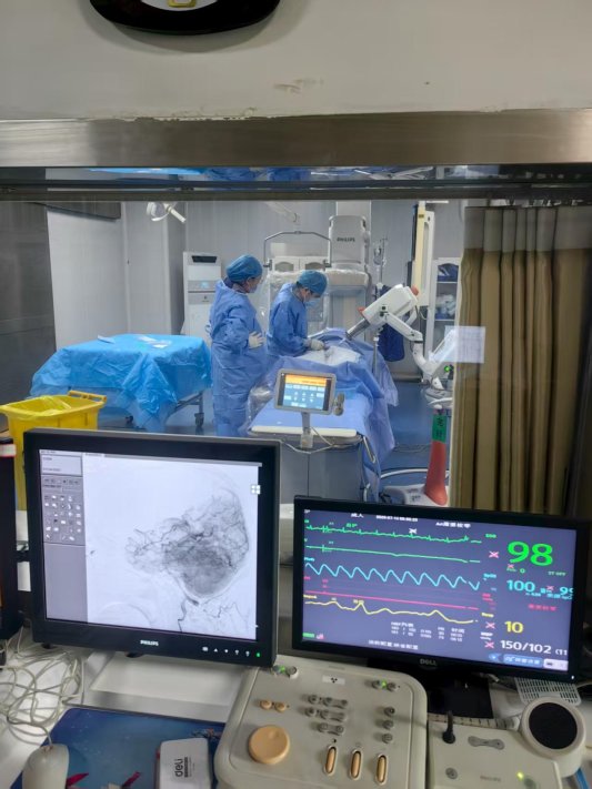 曹县中医医院成功开展两例脑血管造影术