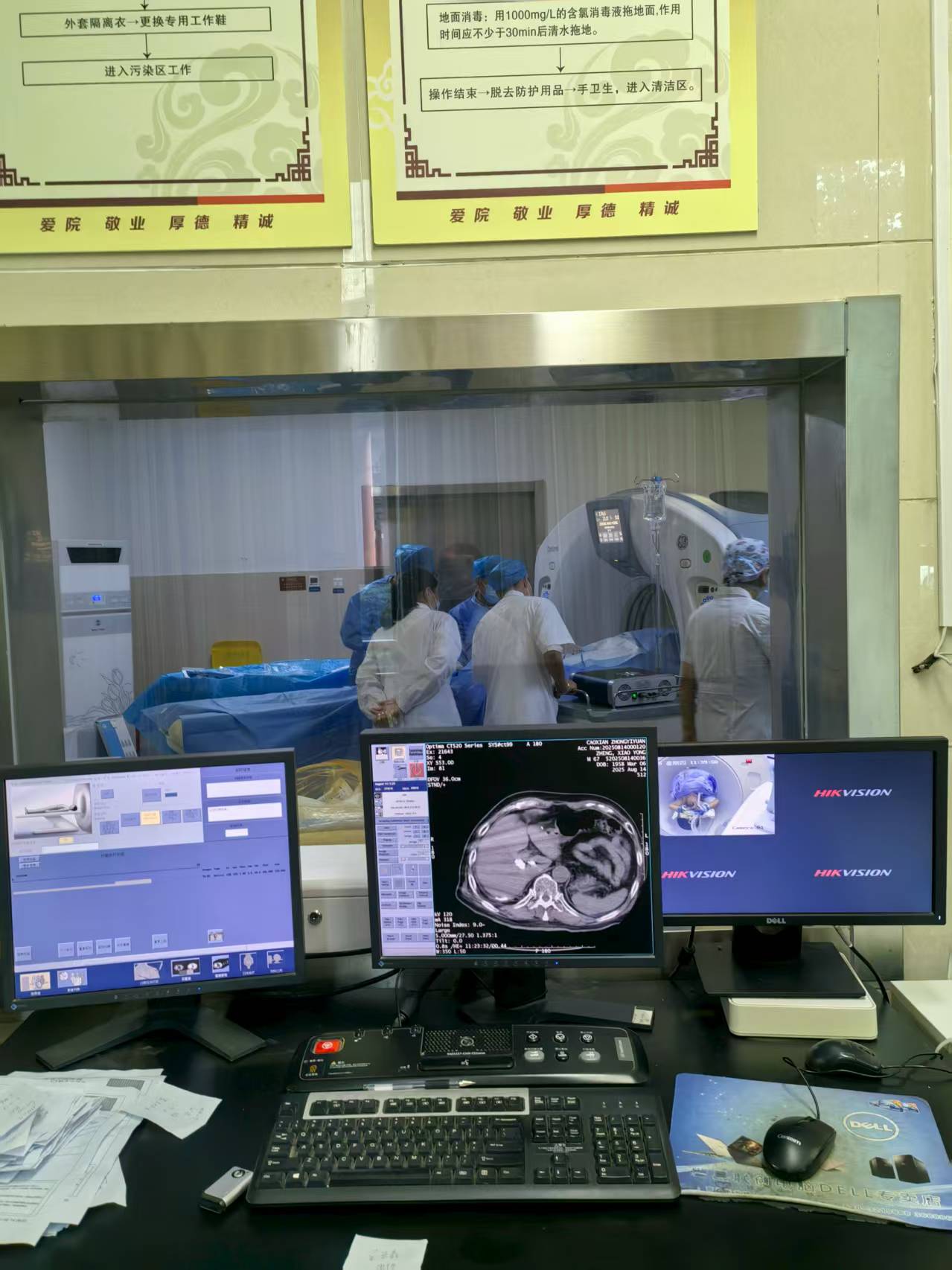 曹县中医医院成功开展微波消融术