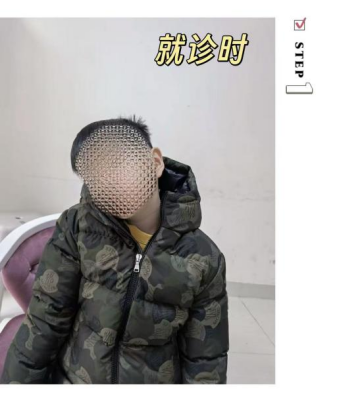 8岁儿童颈部突发疼痛活动受限 济南南郊医院专家手法复位解危机