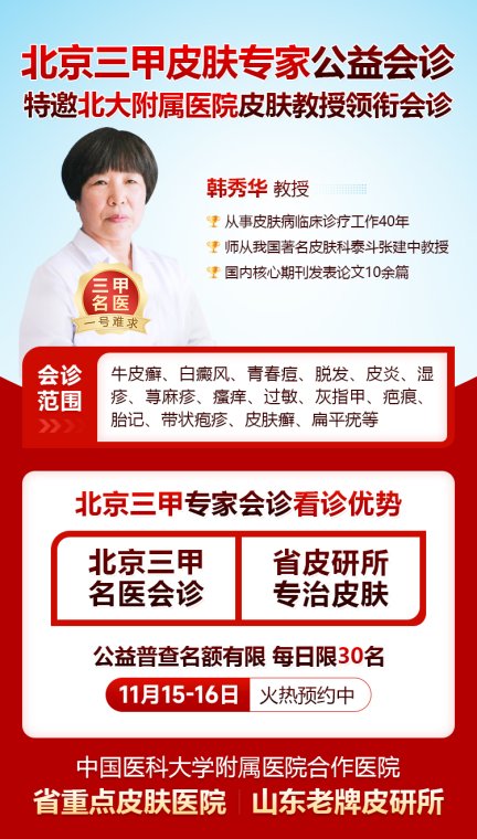 冬痒难耐?银屑病反复?北京皮肤科权威专家韩秀华来济南中研会诊
