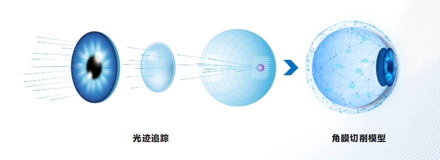 适合参军人群的近视矫正术——郑州尖峰眼科有话说