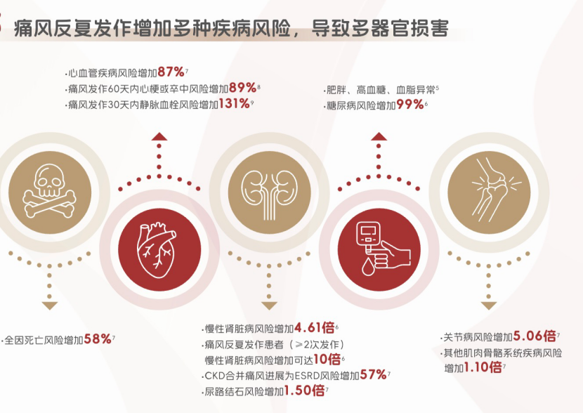 除了秋水仙碱,还有哪些对肾脏影响小的痛风止痛药?
