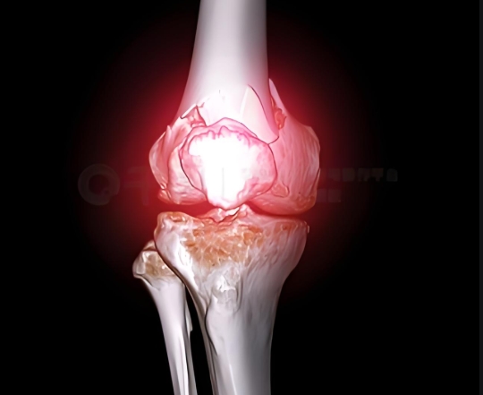 氨糖软骨素钙片的功效和作用是什么?和OTC硫酸氨糖有什么区别