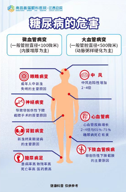 春节后别大意!国家三级眼科南昌普瑞眼科提醒:糖尿病眼病需警惕
