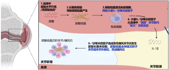 今年团圆饭,终于能举杯了:一位痛风者的长效抗炎管理日记