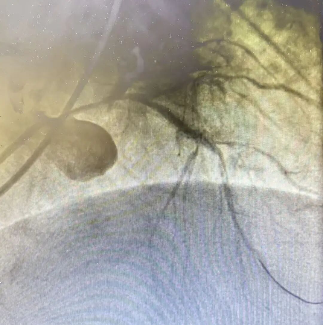 日照心脏病医院:这个团队,敢啃“硬骨头”!