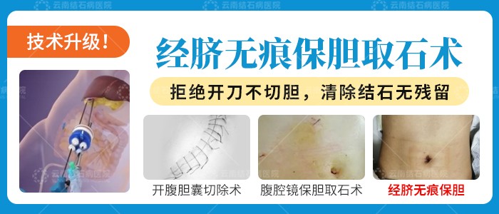 1774857604264492.jpg 20250815经脐保胆-文章-02.jpg