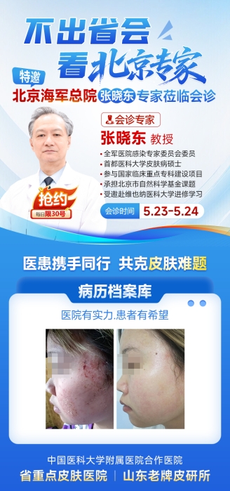 雨天潮湿皮肤病高发!北京皮肤专家张晓东莅临济南中研皮肤病医院会诊