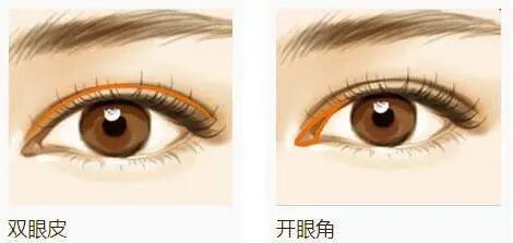 我的眼睛可以做眼睑下至和外眼角吗