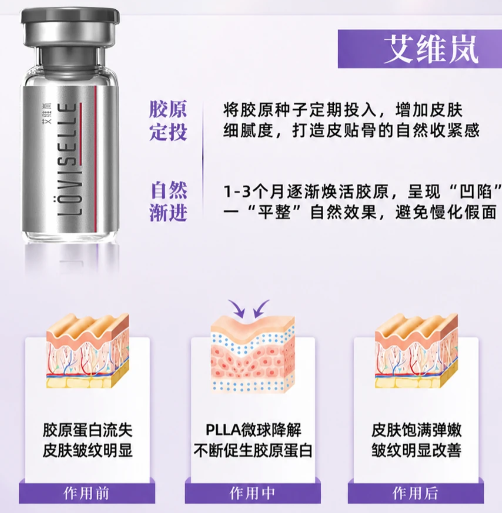 深圳童颜针授权医院怎么查?童颜针认证机构深圳富华、深圳鹏程上美卫士均可预约