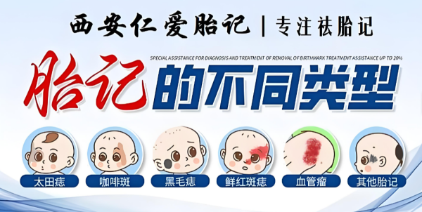 立足患者就医体验,西安仁爱深耕延安患者胎记精细化修护