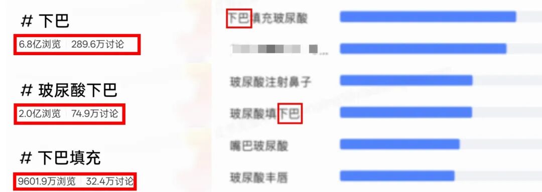 杏林改脸型:下巴填充能改善什么问题?