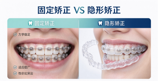 固定矫正 VS 隐形矫正,两种主流牙套该怎么选?可恩医师帮你理性选择