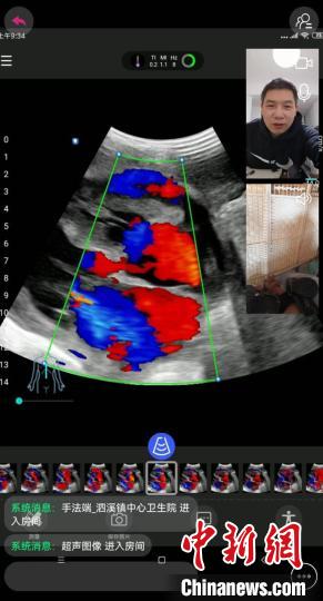 上海专家通过会诊软件开展诊疗。　上海市第十人民医院供图