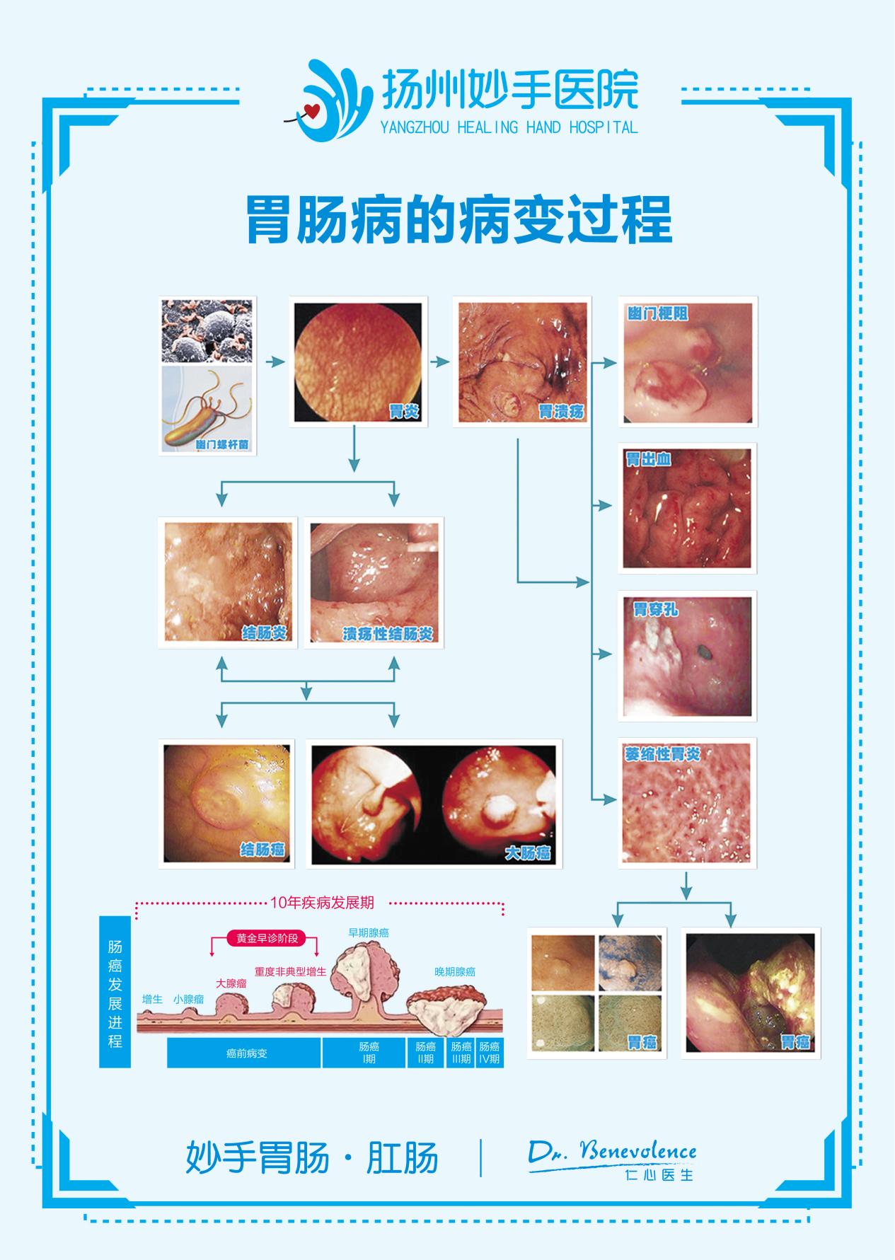 胃肠病治疗