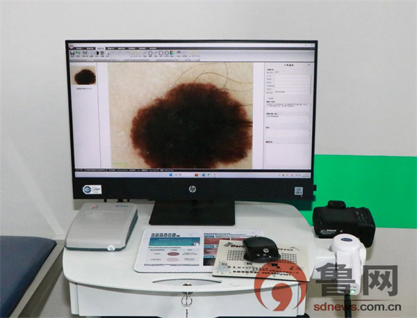 6969皮肤镜检查采用德麦特皮肤镜诊断系统,可显著提高皮肤疾病的