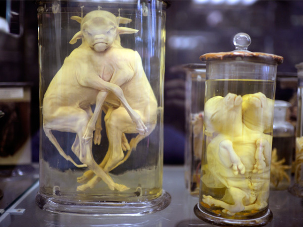 法国畸形博物馆藏品让人直冒冷汗【组图】