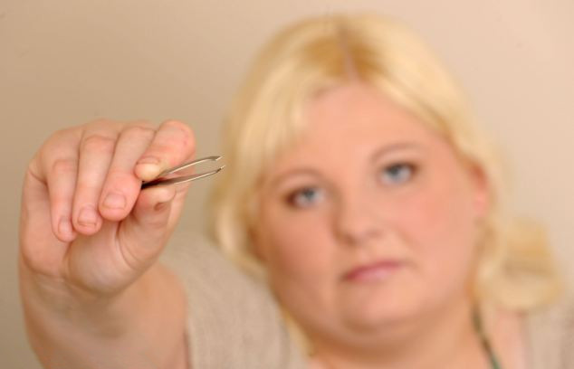 英女子患罕见病拔汗毛成瘾组图