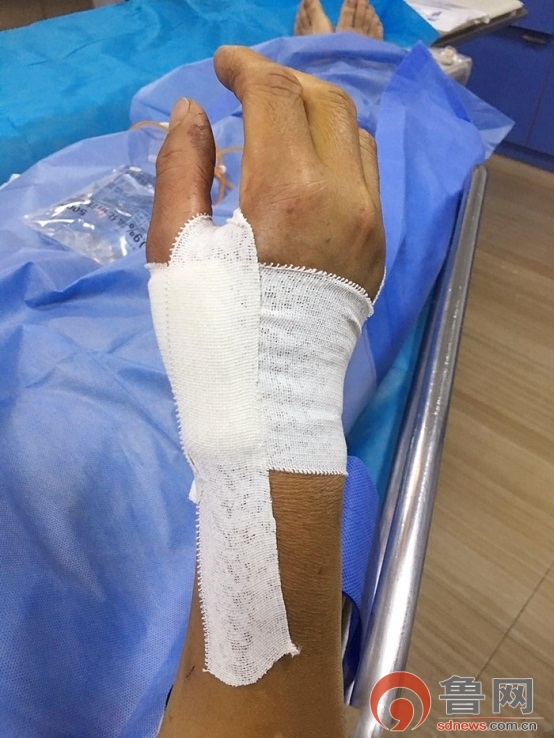 术后加压包扎减少疼痛什么是远端桡动脉穿刺技术?