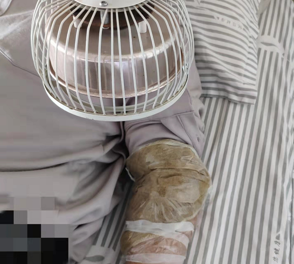 泰安市中医医院中医特色治风湿中药封包有奇效