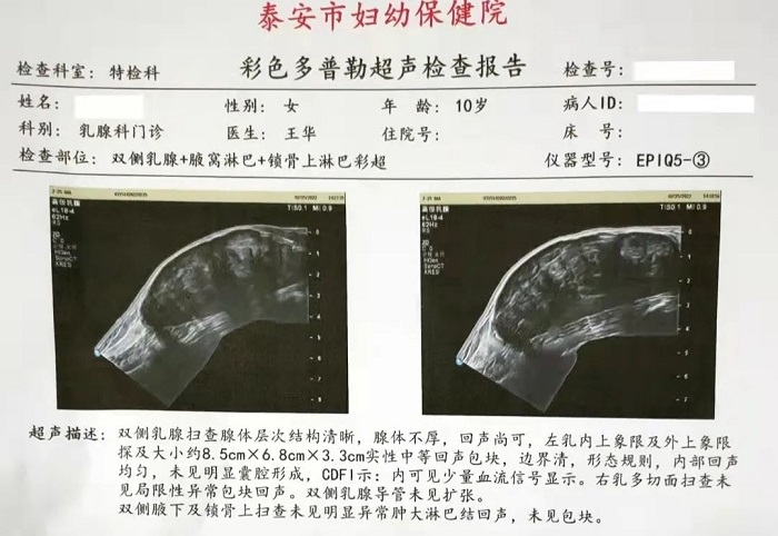 乳腺b超报告单图片图片