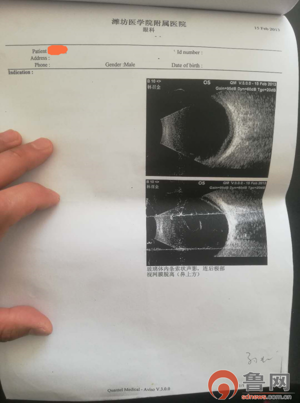 受傷,因為聽說濰坊醫學院附屬醫院在眼科方面比較出名,便慕名趕來檢查