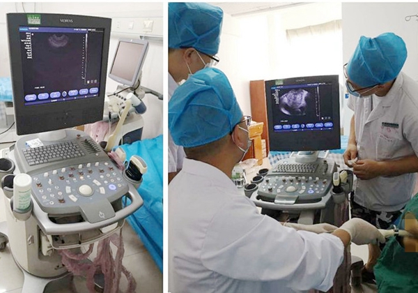 枣庄市薛城区人民医院首次彩超引导下经直肠前列腺穿刺活检术完成